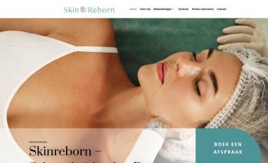 Schermafbeelding van skinreborn.nl