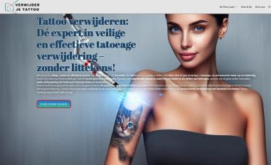 Schermafbeelding van verwijderjetattoo.nl